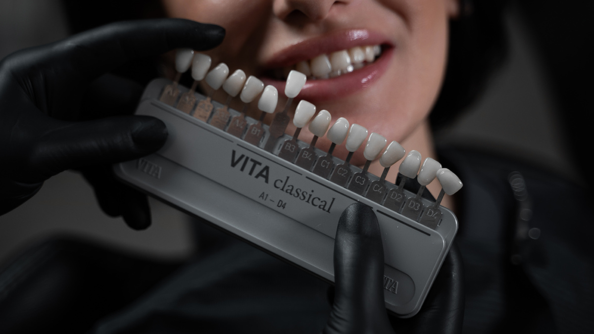 Что такое перебазировка съемного протеза