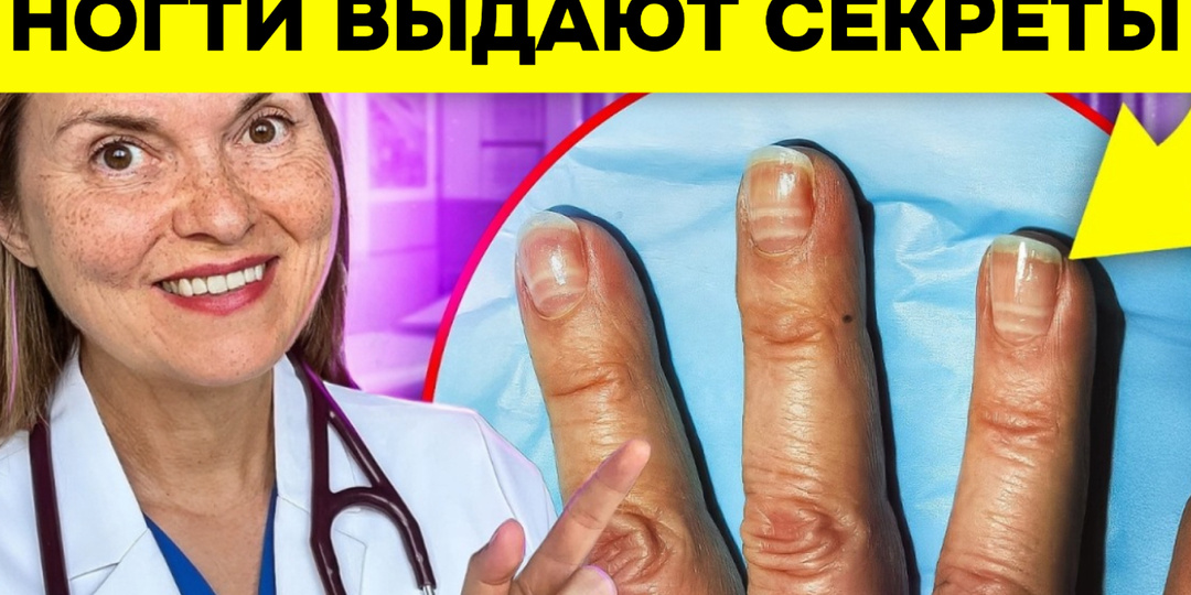 12 скрытых сигналов печени о помощи: что расскажут ваши ногти и не только