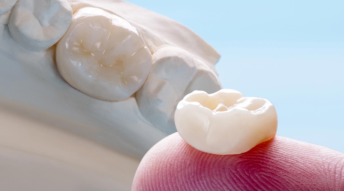 Коронка из диоксида циркония