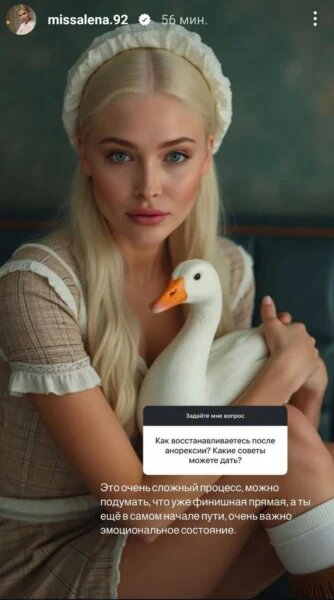    Алёна Шишкова. Фото: соцсети