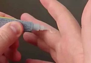 Как расклеить пальцы от суперклея