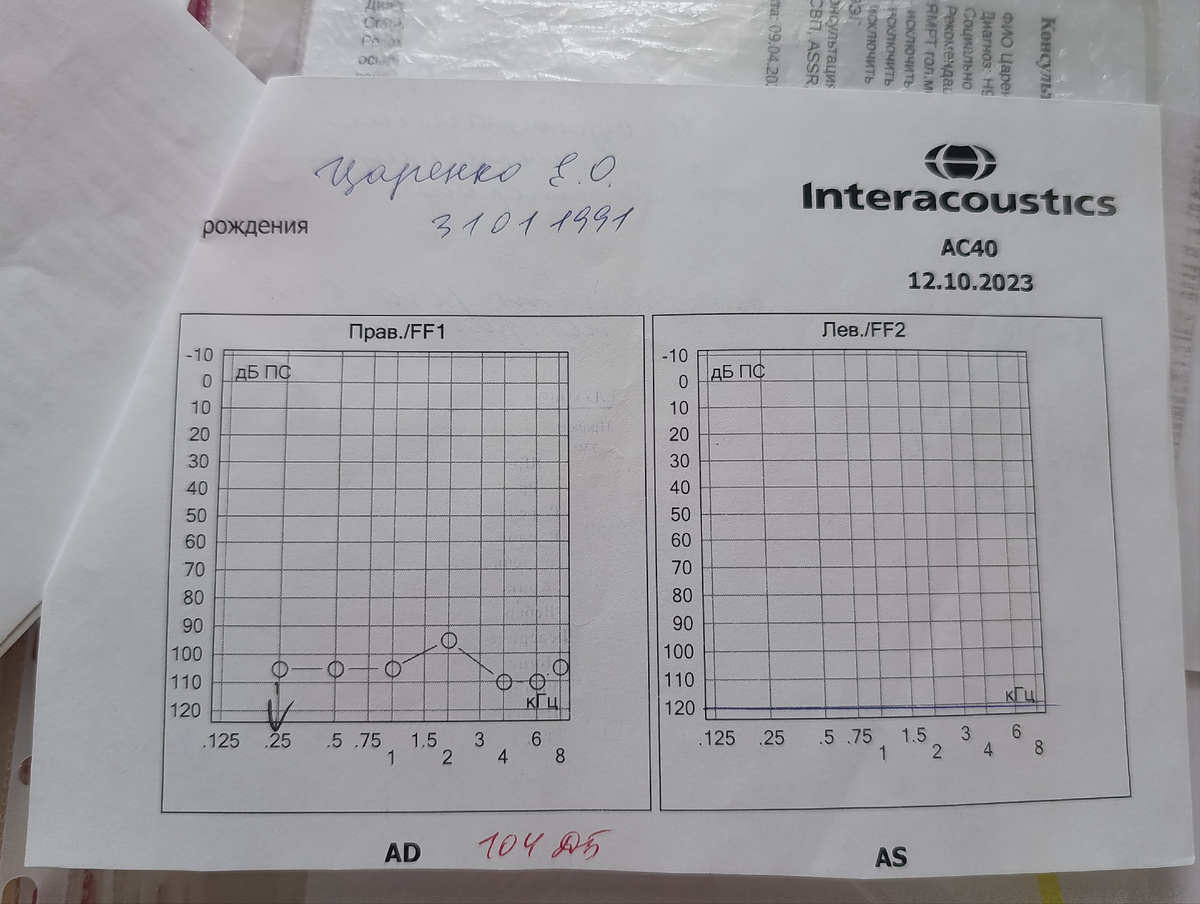 Это моя аудиограмма