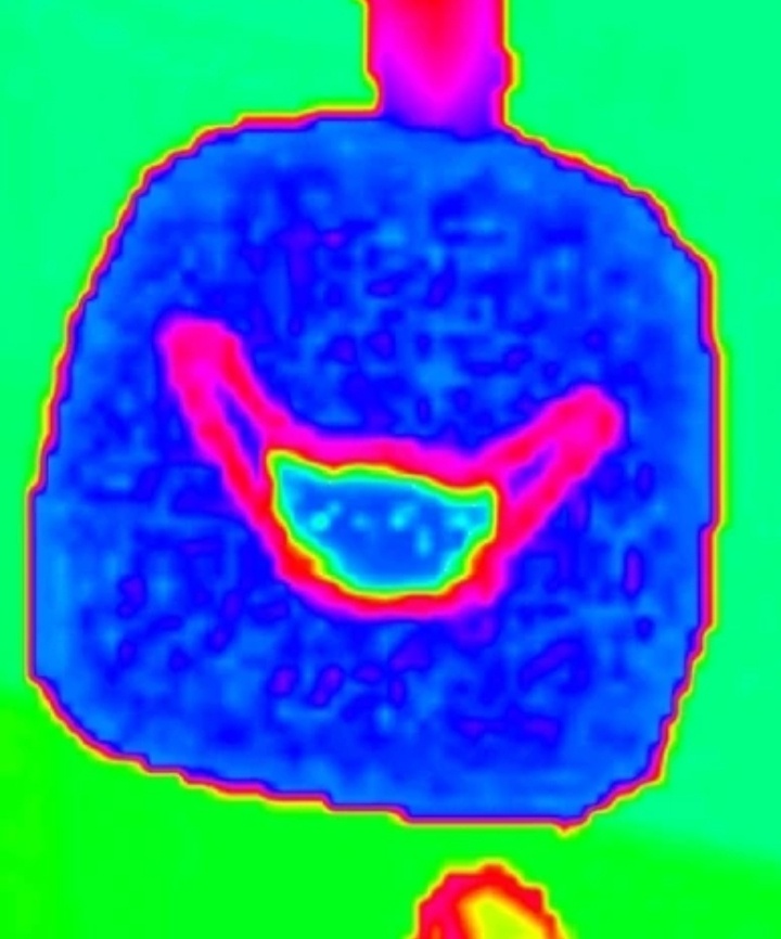 Кошмарная улыбка 3 место