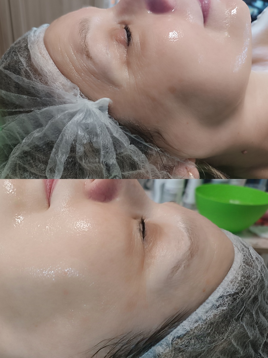 Результат клиентки за одно посещение 