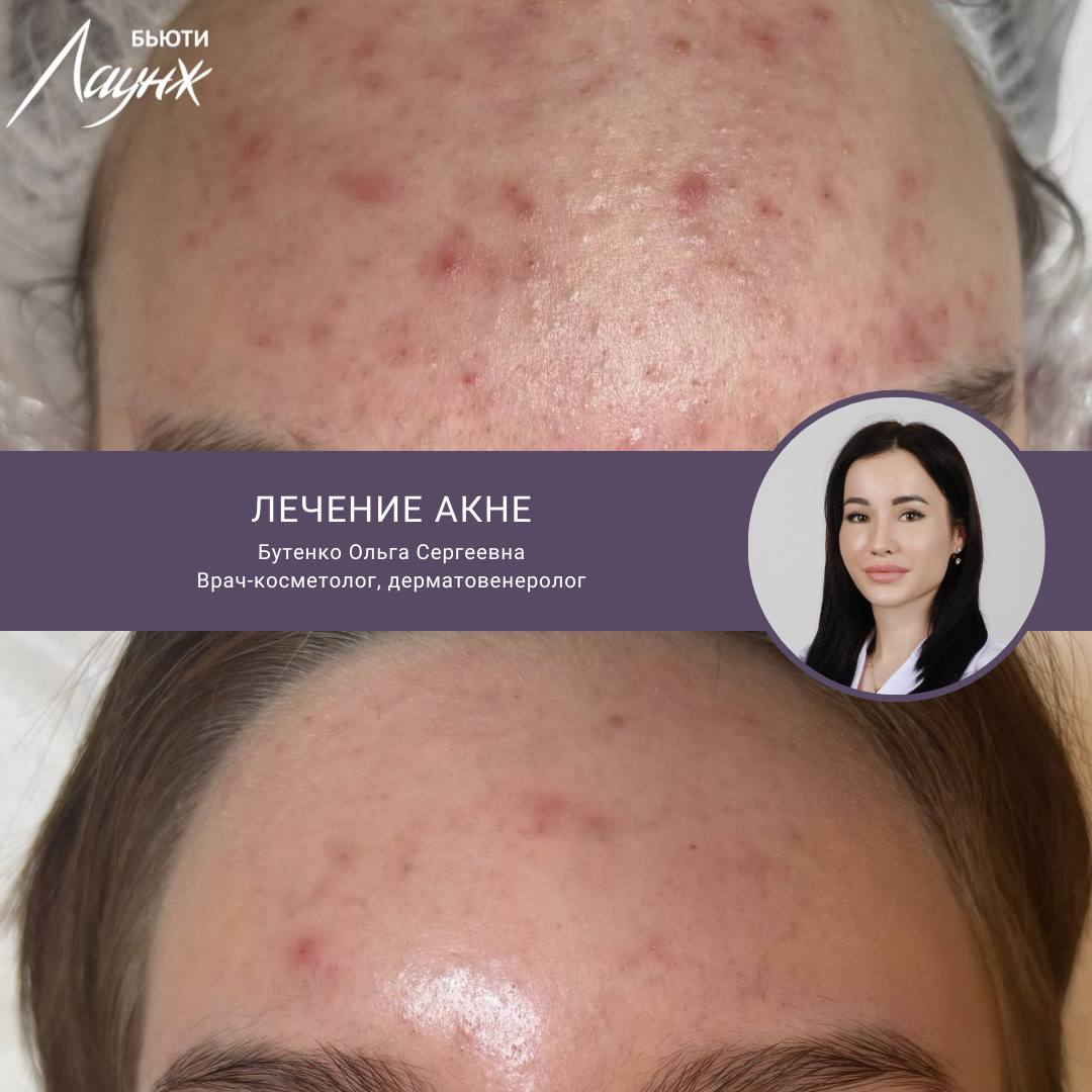 ИМЕЮТСЯ ПРОТИВОПОКАЗАНИЯ, НЕОБХОДИМА КОНСУЛЬТАЦИЯ СПЕЦИАЛИСТА