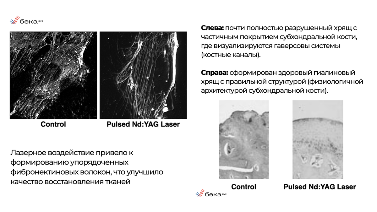 Результат применения Hilterapia в лечении остеоартроза