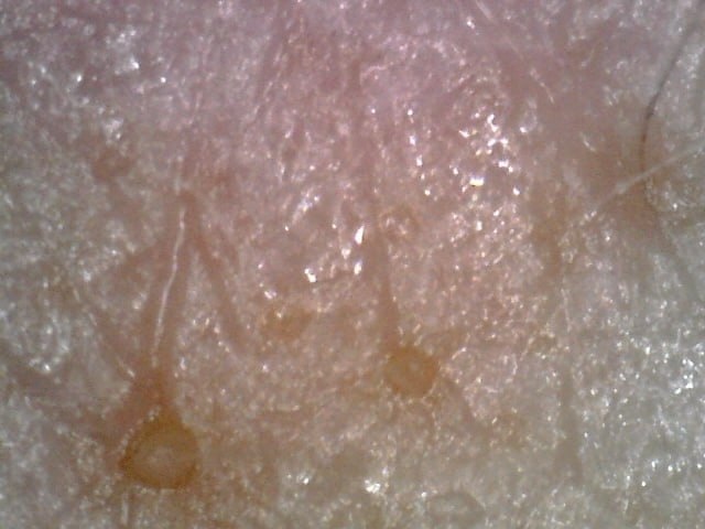 Кожа под электронным микроскопом.