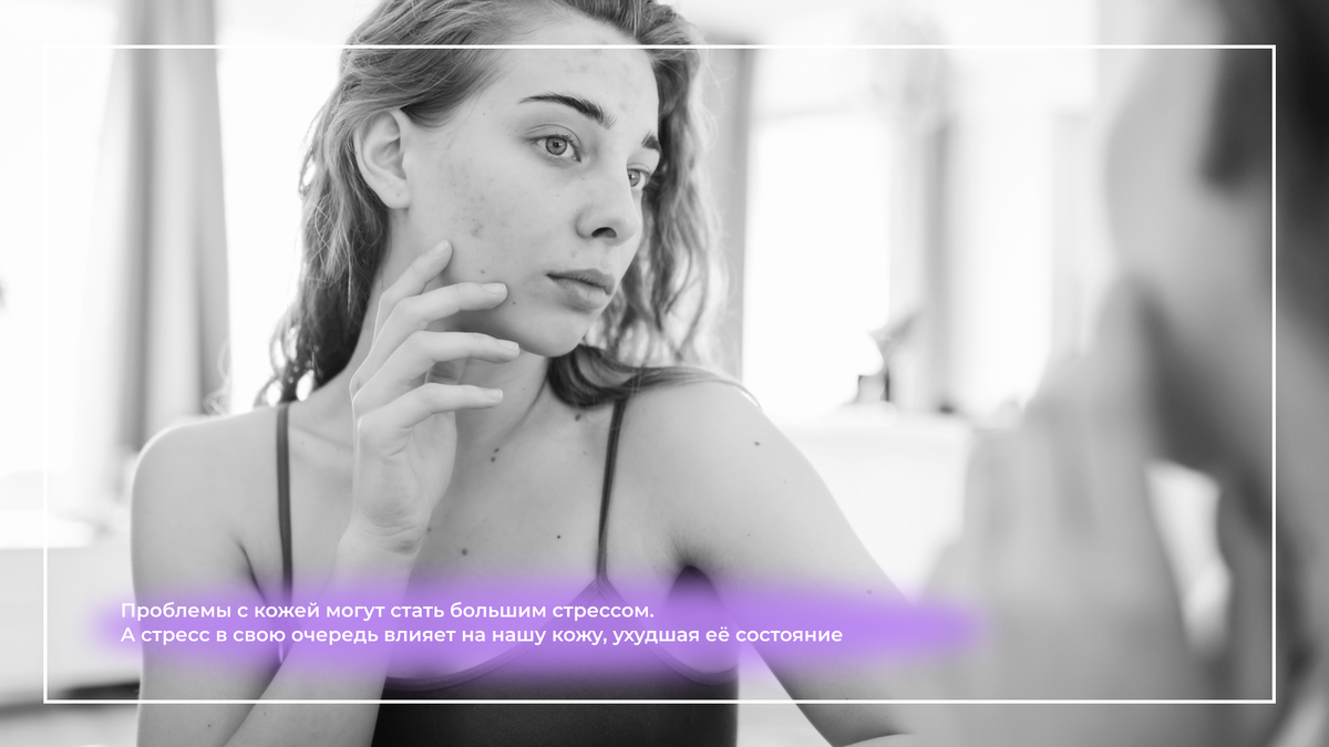 Несколько исследований показали, что лечение акне действительно помогает справиться с симптомами депрессии