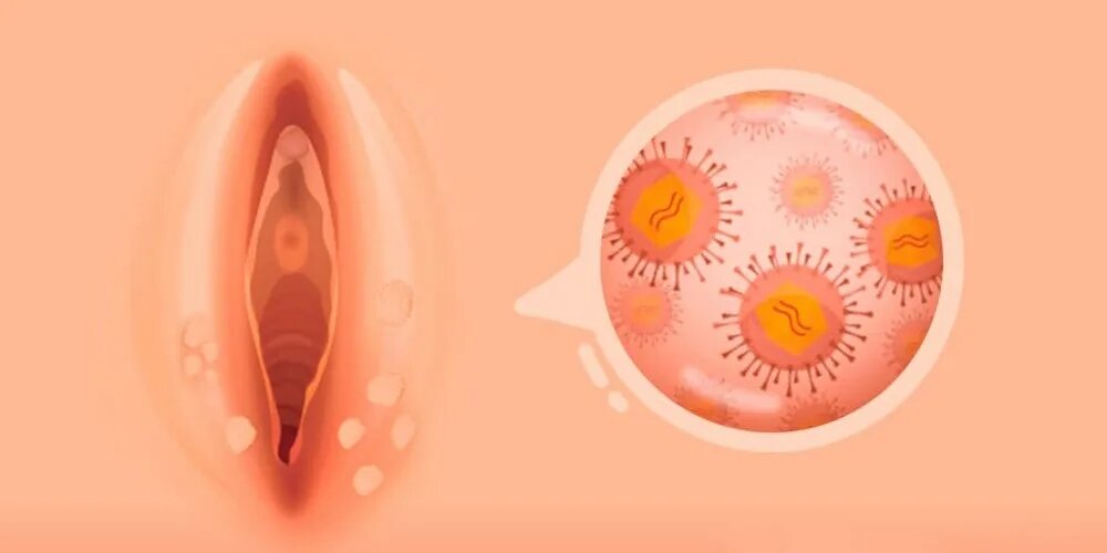 Фото: Яндекс.Картинки