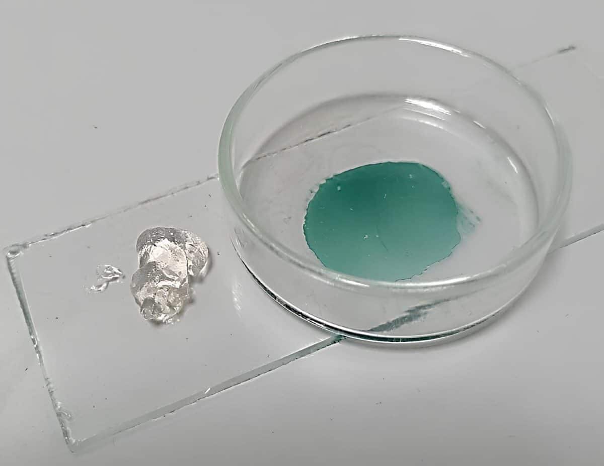    Противомикробный фотосенсибилизирующий гель на основе галлиевого комплекса природного хлорина / © Галина Гаменюк, студентка Института тонких химических технологий имени М. В. Ломоносова РТУ МИРЭА, пресс-служба РТУ МИРЭА