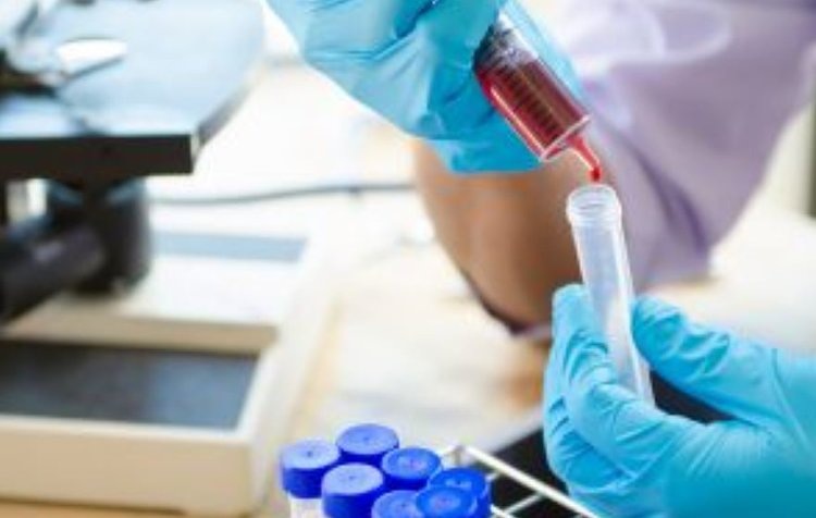    Лучше защитить диких животных от бешенства помогает новаторская методика ФГБУ «ВНИИЗЖ»