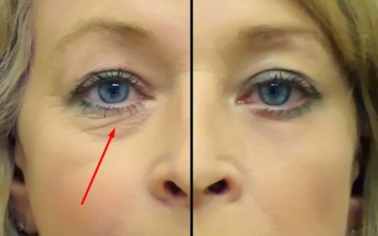 Справа фотошоп, а картинка - из интернетов