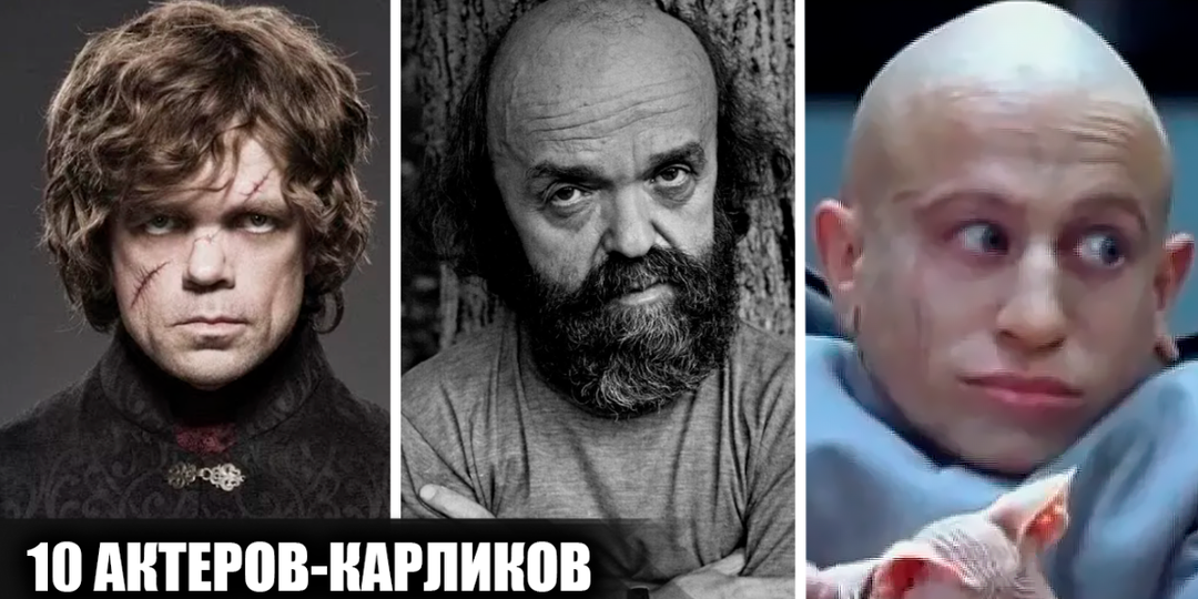 10 известных актеров-карликов, которые смогли добиться успеха в кино и на телевидении