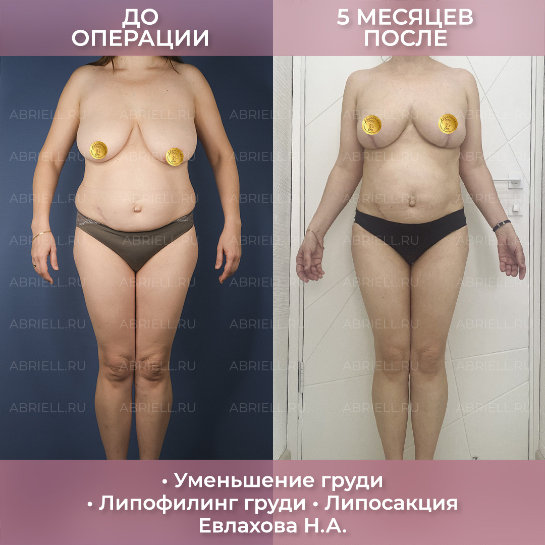 Пластический хирург: Евлахова Н.А. 