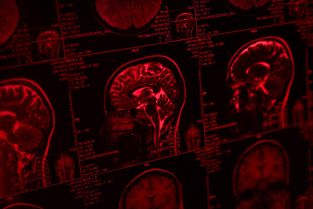 Токсическое поражение мозга. (Источник изображения freepik.com)