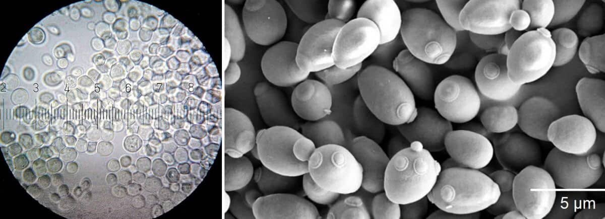 Дрожжи под электронным микроскопом / © Wikimedia Commons, Sigi Hiss📷
