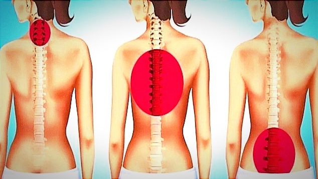 Безопасные упражнения для спины❗