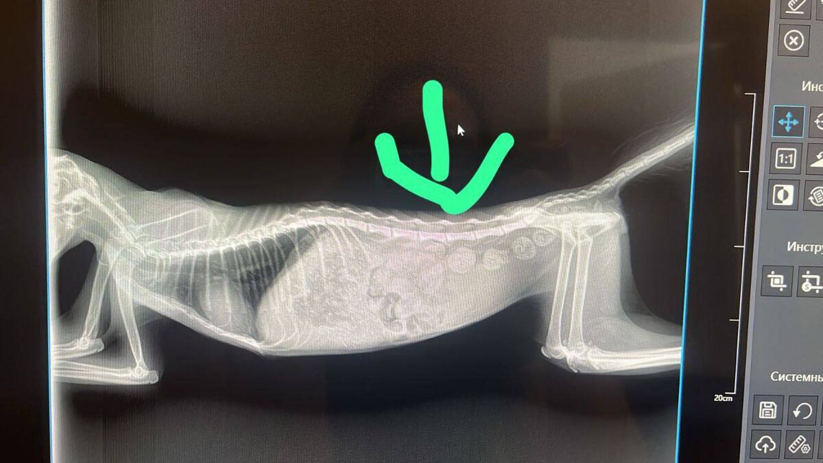 Рентген позвоночника Алисы. Фото из архива автора