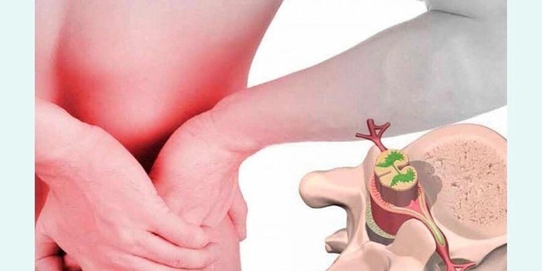 Как лечить межпозвоночные крыжи? Артур Сабуров