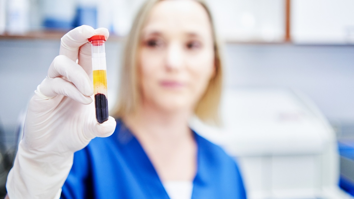    Ученые нашли отпечатки рака в крови с помощью инфракрасного света