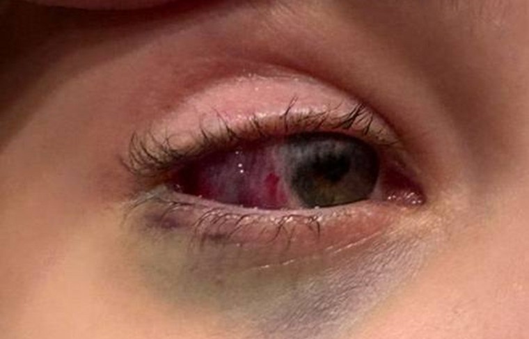    Личный архив пострадавшей