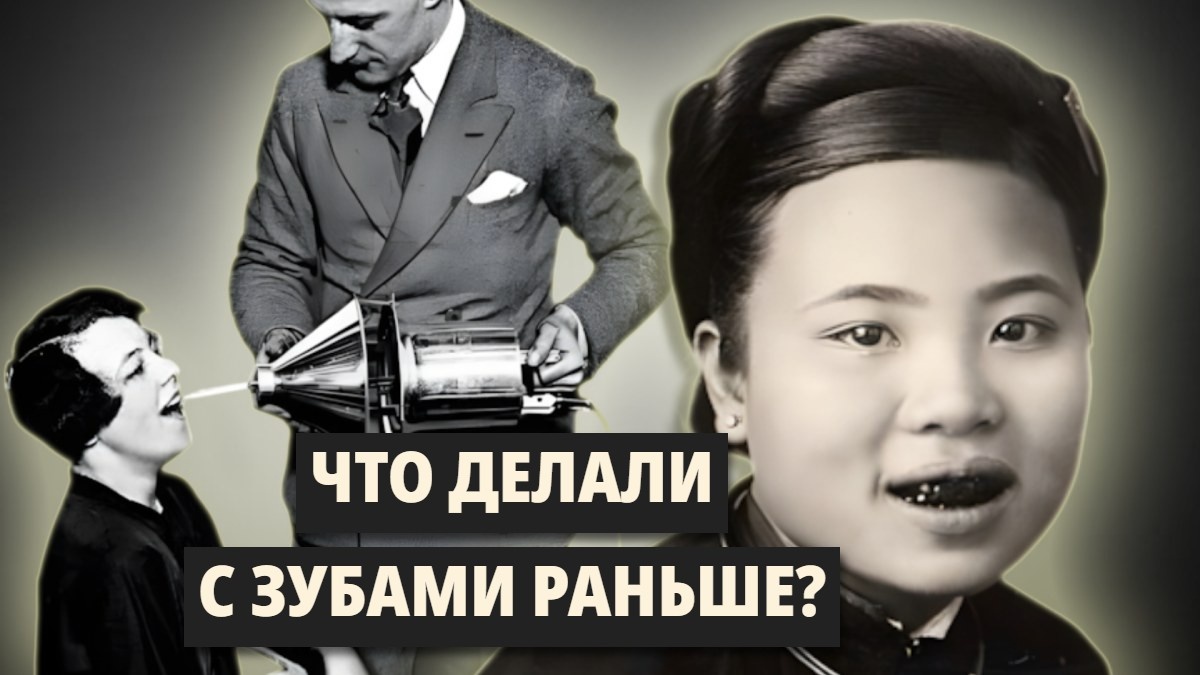 Лечение зубов в древности: после таких «методов» современные стоматологи уже не напугают вас