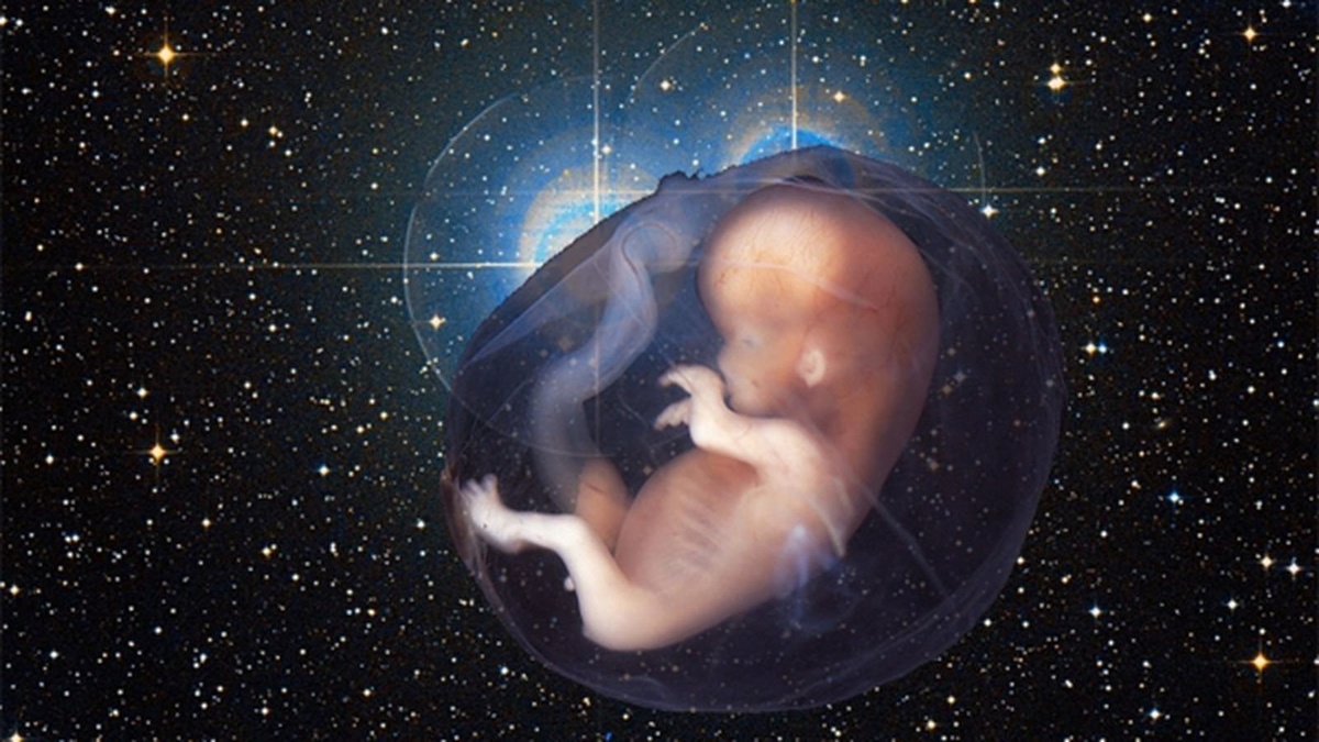 Картинка с ресурса Яндекс.