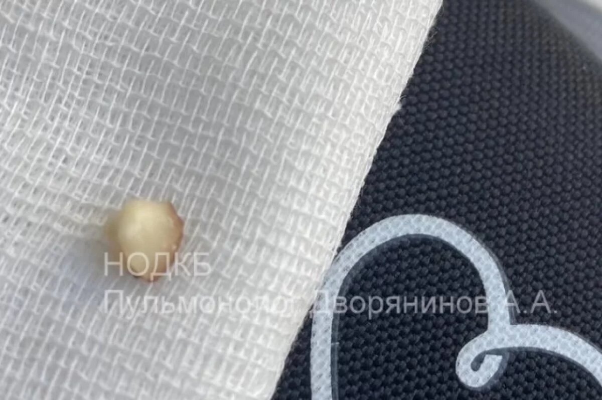    Подавившегося орехом малыша спасли нижегородские врачи