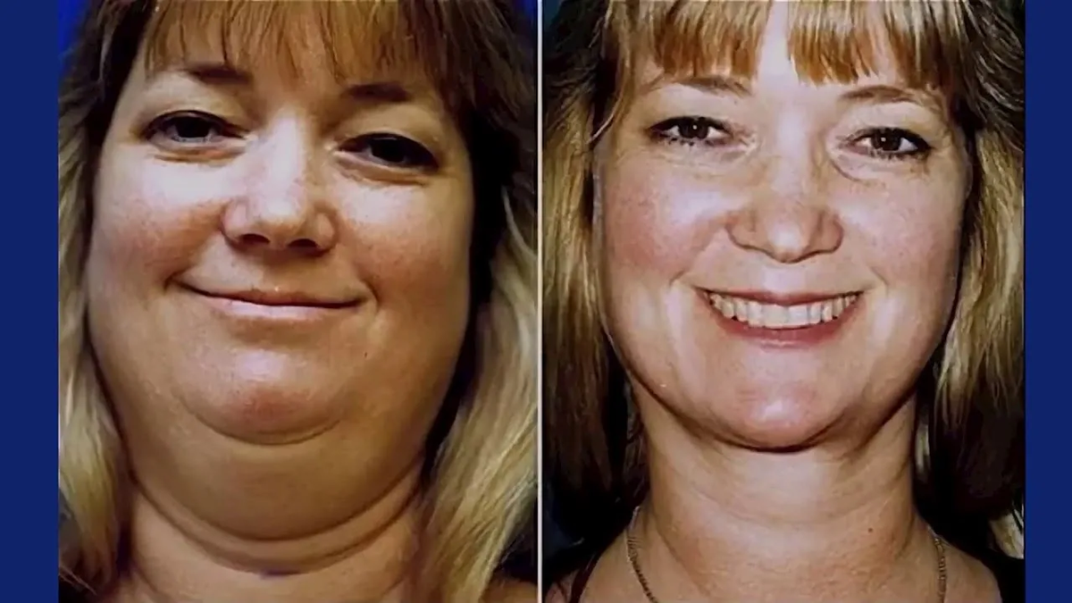 Что делать, чтобы не отекать с утра: простые способы 