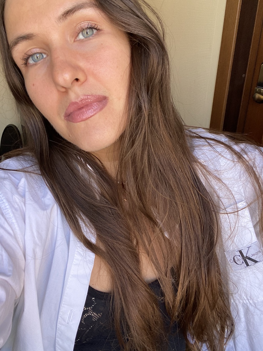 А так выглядит лицо с загаром без косметики ( без тона, румян, консилера) на утро следующего дня после процедуры моментального загара.