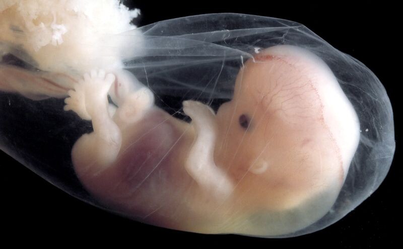 Эмбрион человека.