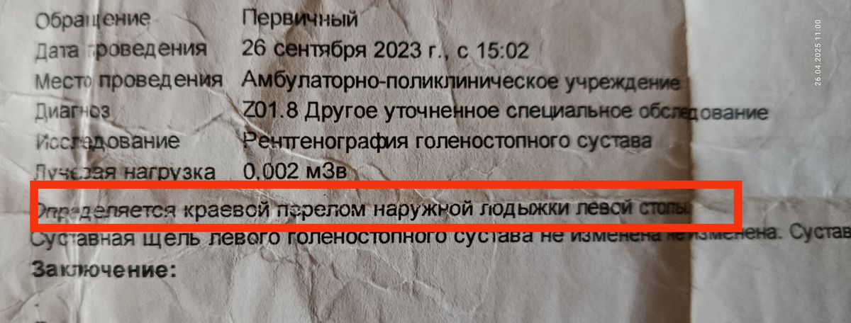 Перед госпиталем до кучи делала рентген, чтобы проконсультировали и по этому суставу