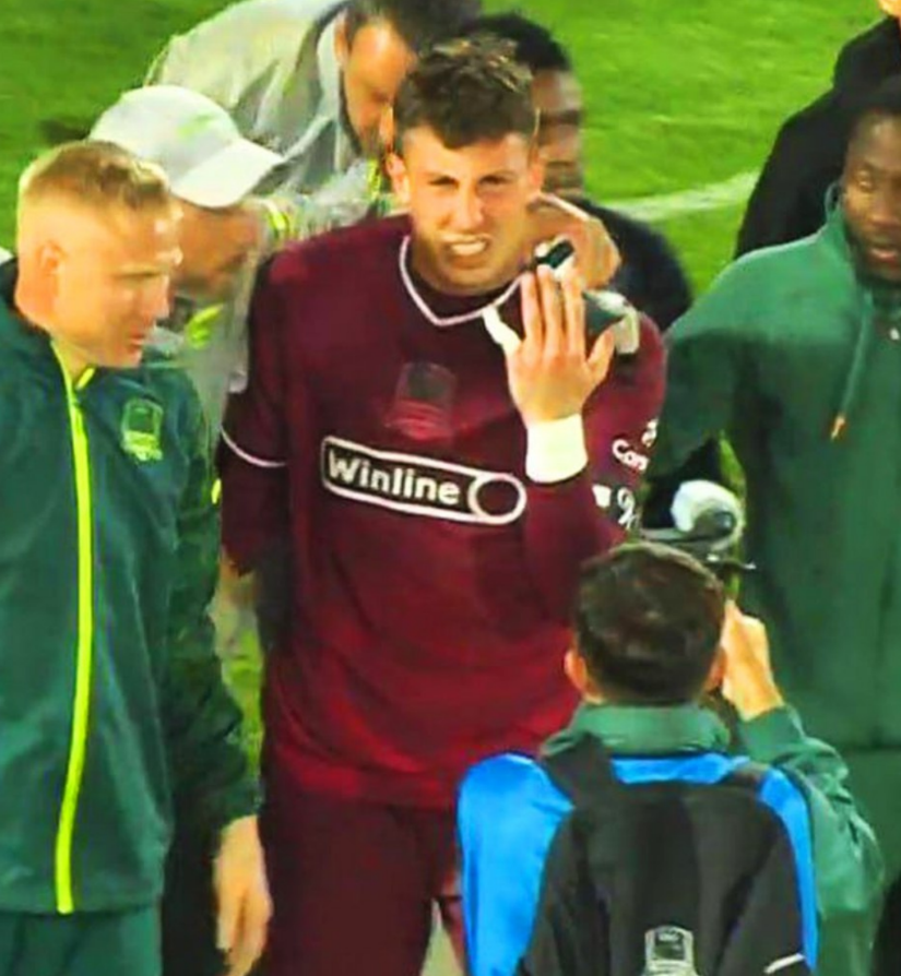 Фото сломанного пальца Станислава Агкацева. Источник: чемпионат.ком