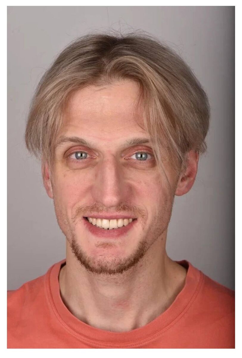 Фото "после"