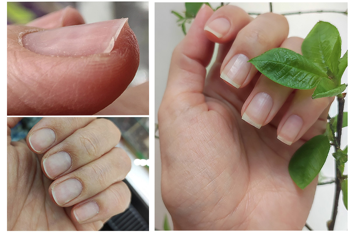 Мои ногти в январе 2024 года и сейчас, в апреле 2025 года 