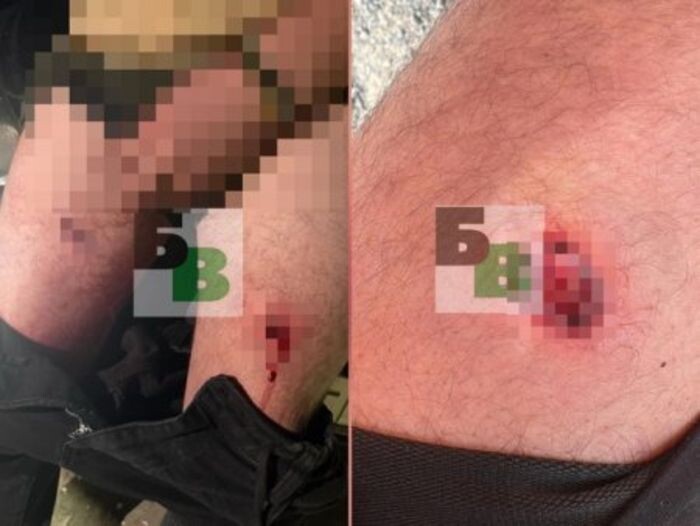 Источник фото: battime.ru
