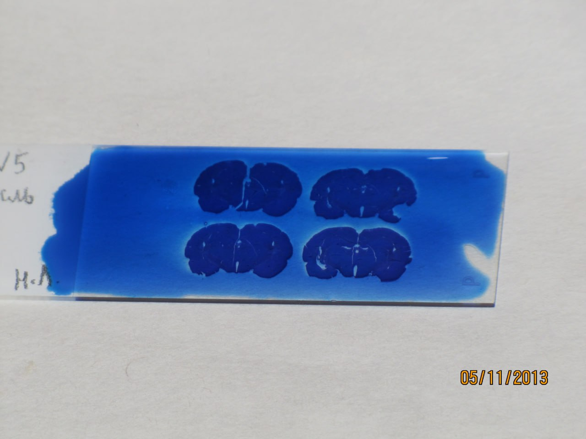 Первая стадия окраски