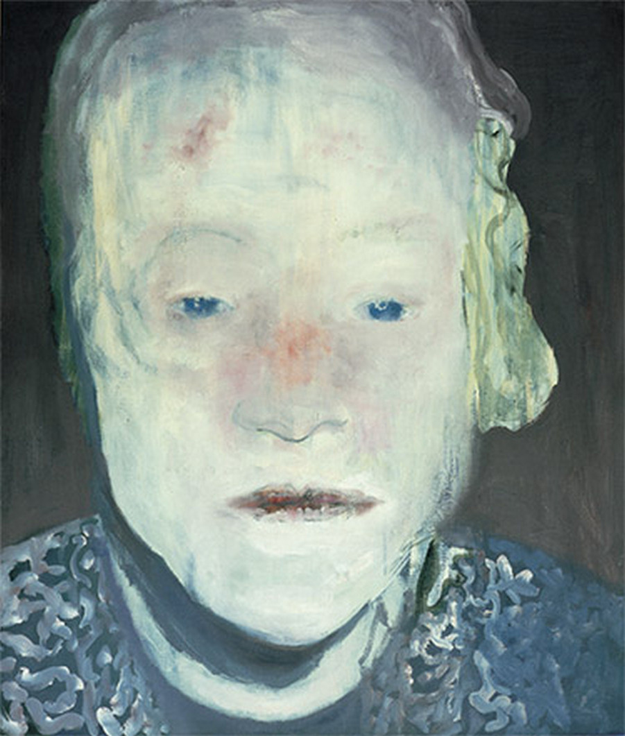 Белая болезнь / The white disease. 1985