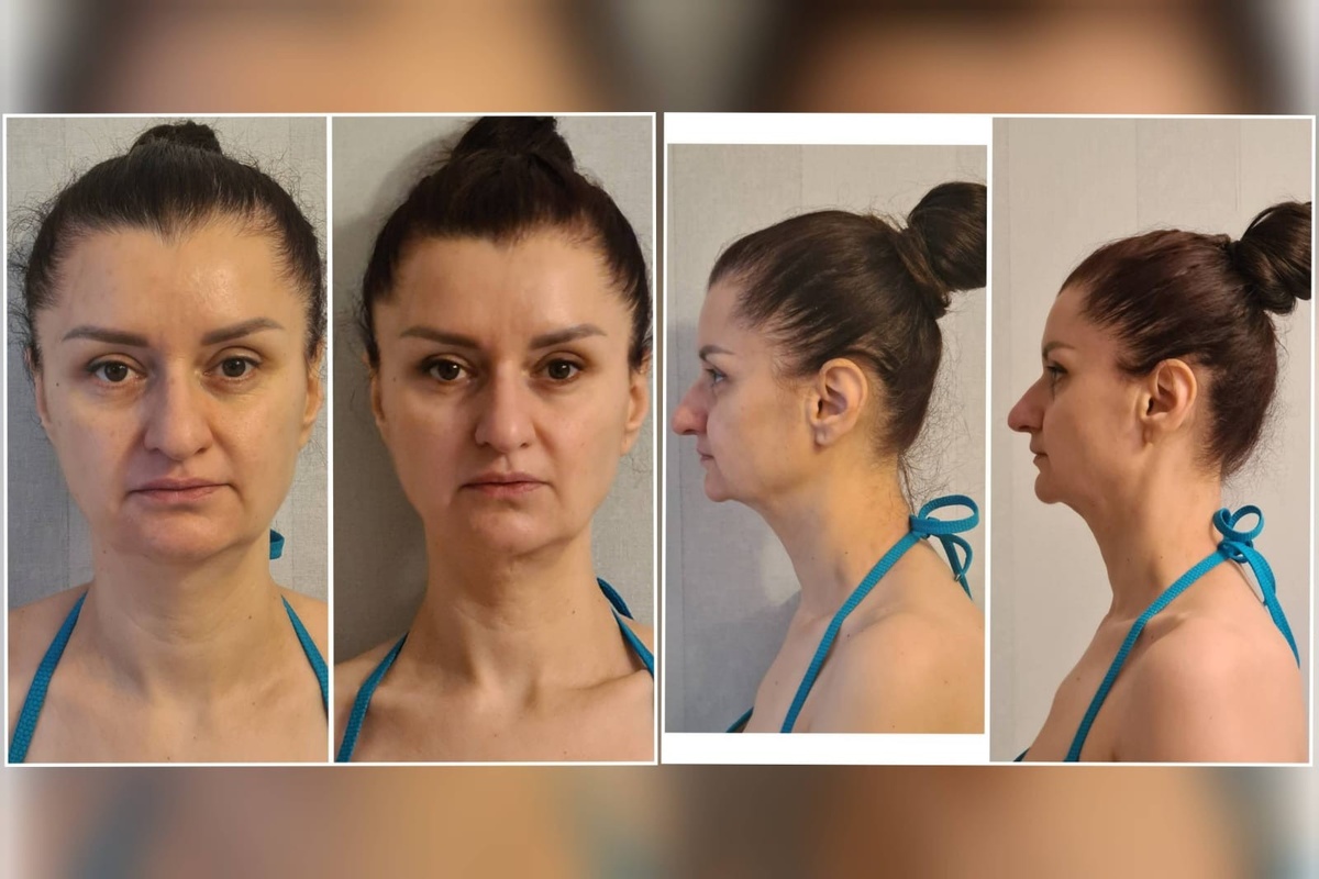 Юлия до программы "DIVAпреображение" и после