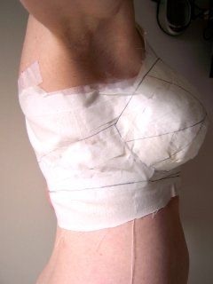 "Преобразите свою фигуру: Увеличение груди с гарантией качества и комфорта в Frau Klinik!"