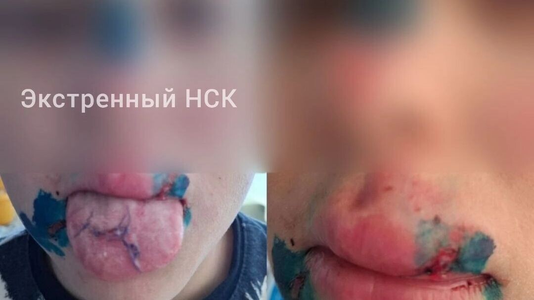     Источник: Экстренный НСК