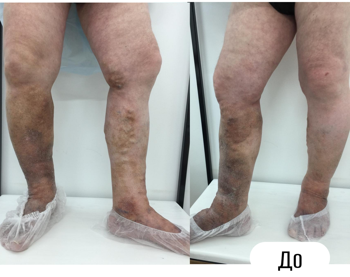 До операции