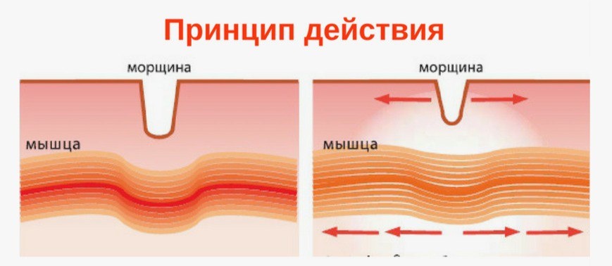 Иллюстрация взята из открытого Интернет-источника