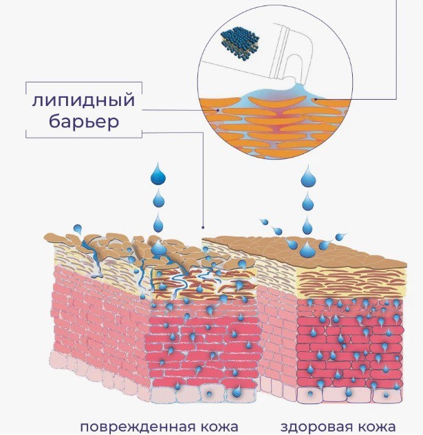 Иллюстрация взята из открытого Интернет-источника