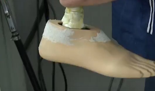     В крае работают 4 предприятия по протезированию бойцов СВО