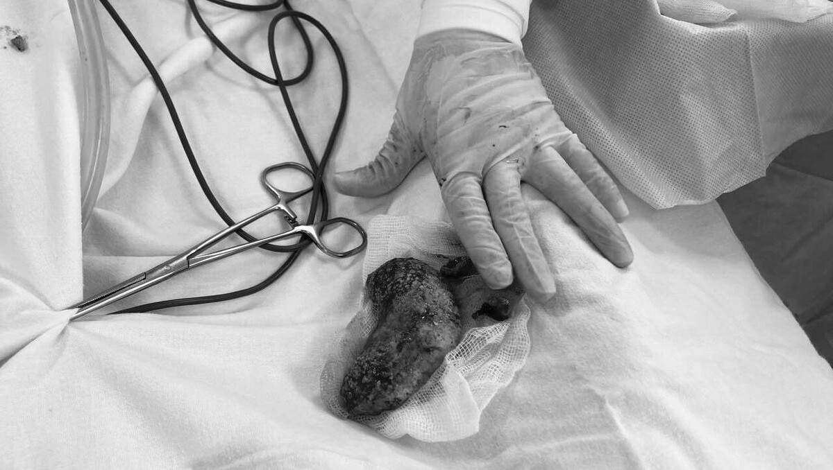     Источник: пресс-служба минздрава УР