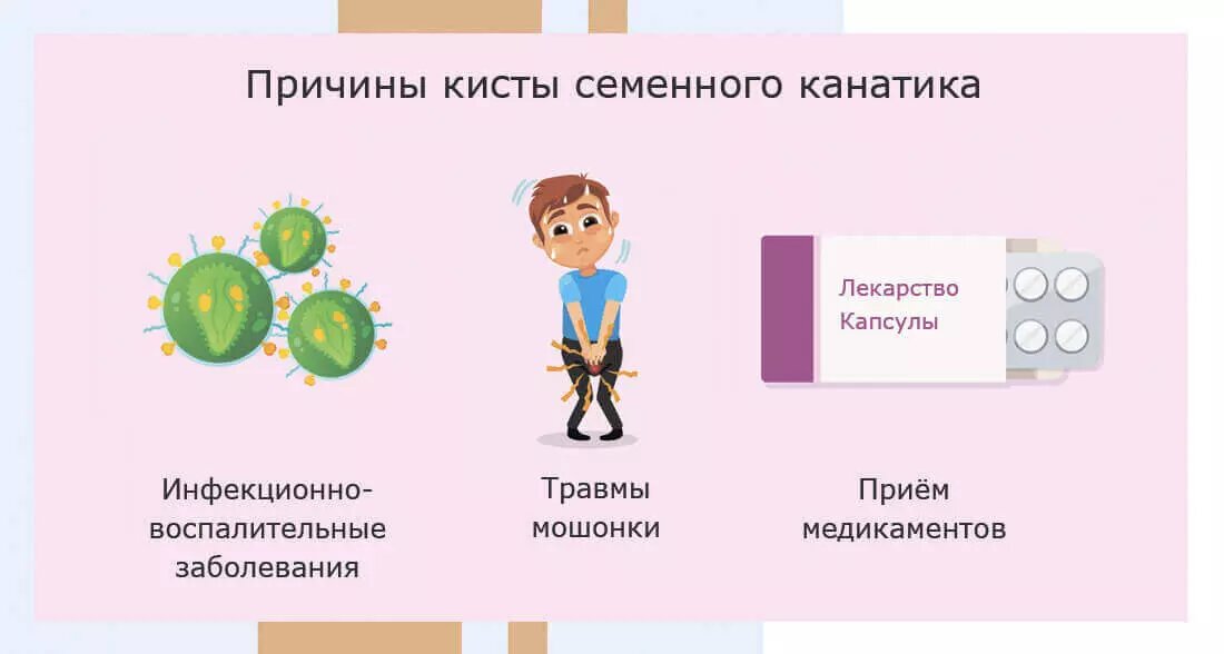 Причины кисты семенного канатика