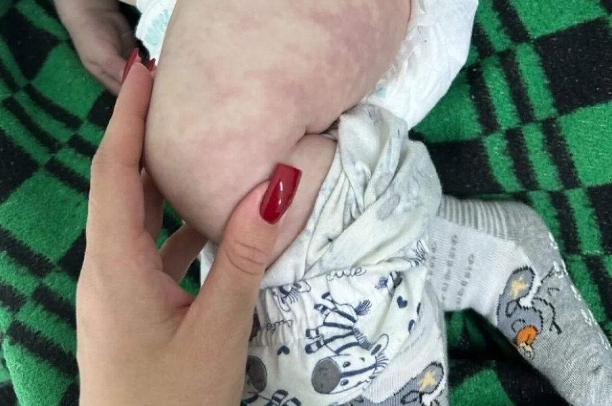    Отец ребенка считает, что врачи могли спасти ребенка, но не предприняли необходимых мер и потратили драгоценное время