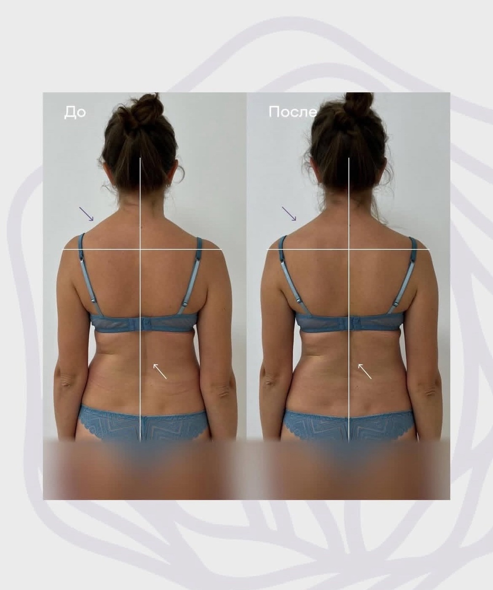 КЛИНИКА "ОСТЕО ЛАЙТ"