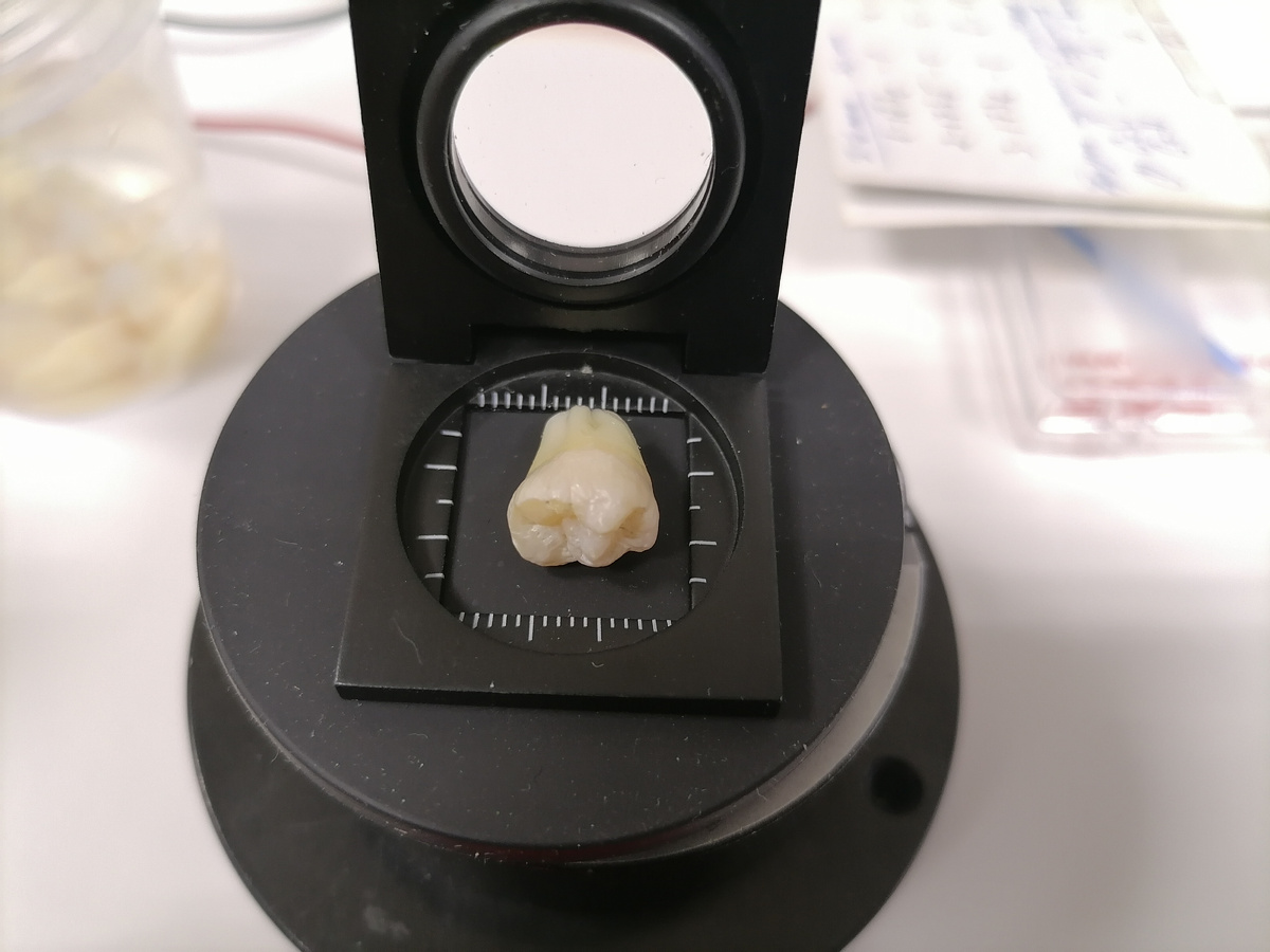 Образец интактного зуба. Источник: Павел Середин